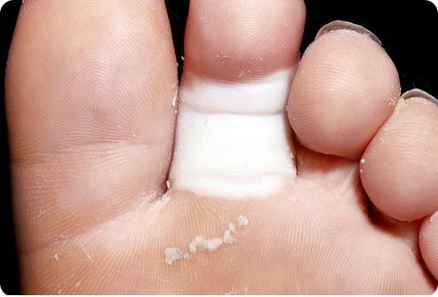 Causas de la fractura de los dedos del pie