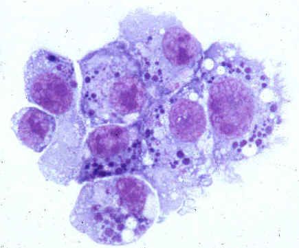 Patógenos de la anaplasmosis humana (familia Anaplasmataceae)
