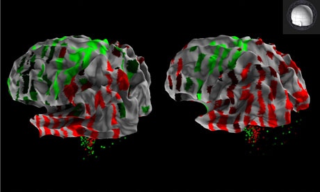 Creó el primer atlas del cerebro humano del mundo