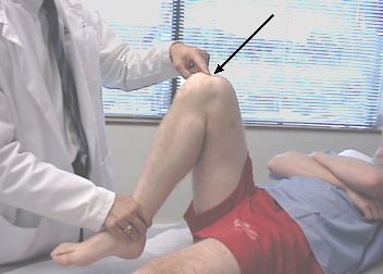 El dolor en la rodilla durante la flexión es la razón más común por la que las personas visitan a los médicos especialistas en trauma. 