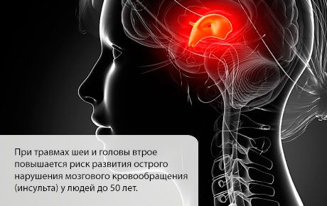 La probabilidad de un accidente cerebrovascular aumenta en los primeros meses después de una lesión en la cabeza o el cuello