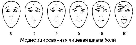 Escala de dolor facial modificada